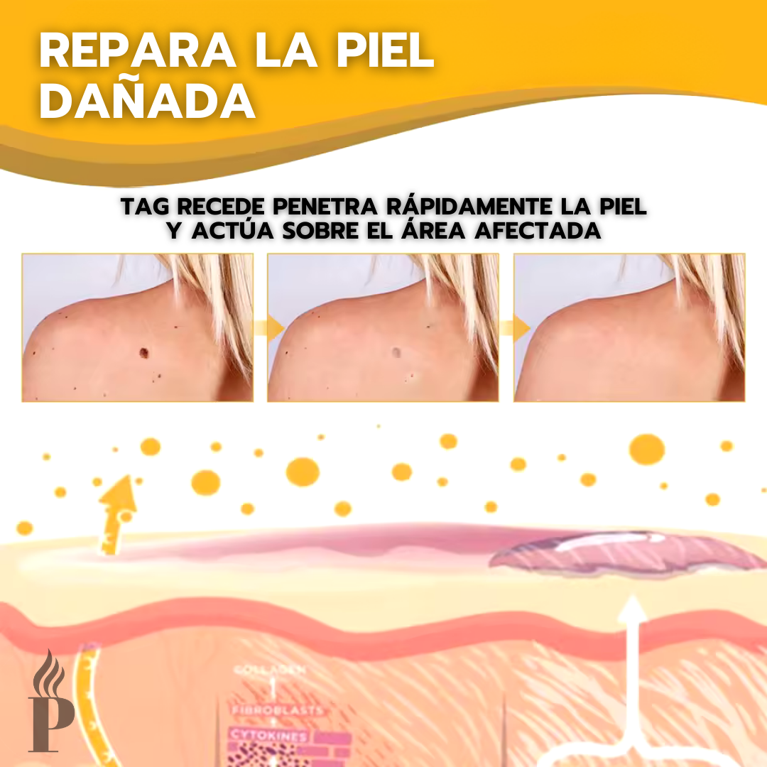 Oferta Especial 2x1: Tag Recede™ - Eliminador de Verrugas Inmediato