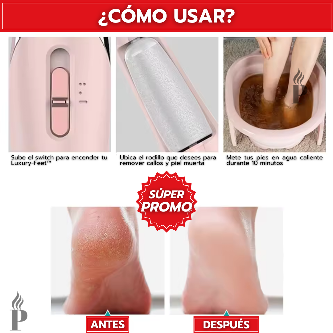 Luxury-Feet™: Removedor De Callos Inalámbrico Recargable