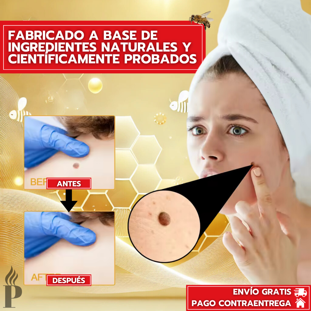 Oferta Especial 2x1: Tag Recede™  - Eliminador de Verrugas Inmediato